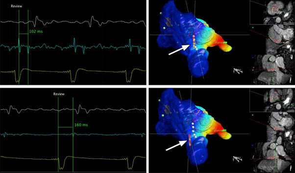 Cardiac Electrophysiologist Near Me